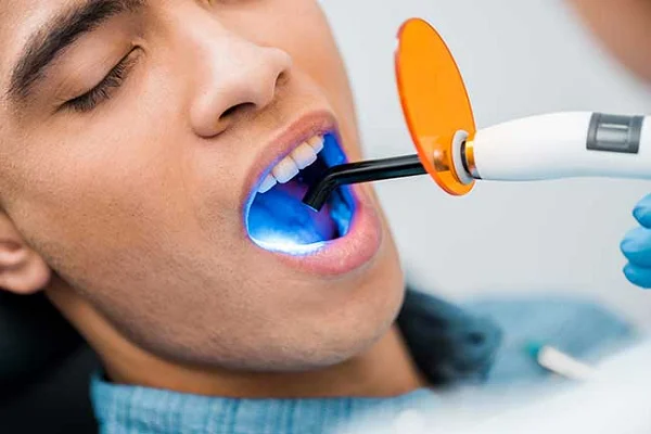 Laser Dentistry